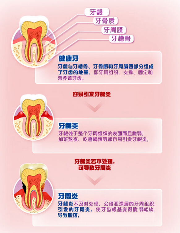 功效:去除牙菌斑,防止蛀牙,强健牙齿,口气清新,健康牙龈.